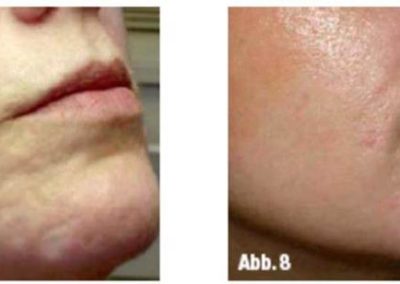 Advanced Cell Stimulation