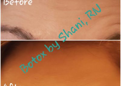 Eyebrows Raised - Before & After